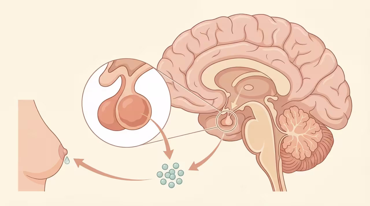 Hyperprolactinemia in Women